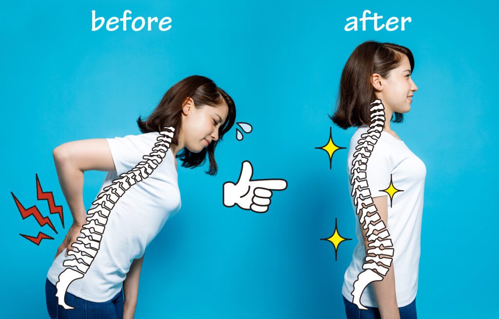 Before And After Image
